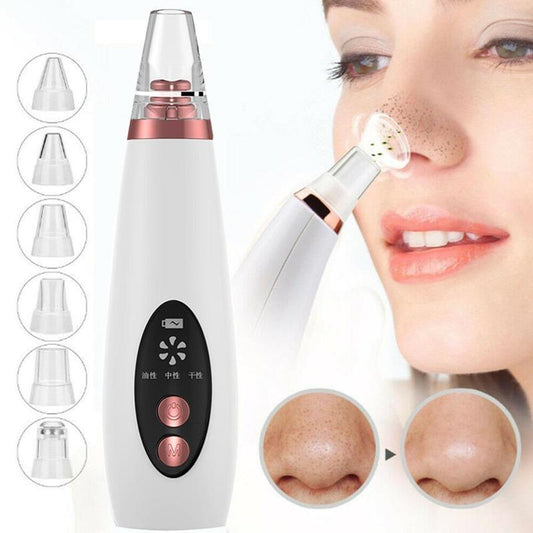 Blackhead Pore Vacuum Cleaner Be Up For Life